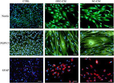 Conditioned Media From Glial Cells Promote a Neural-Like Connexin Expression in Human Adipose-Derived Mesenchymal Stem Cells